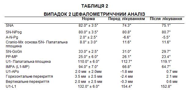 Таблиця 2